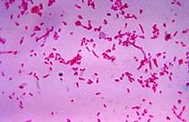 : : : : : : : : : : : : : : : : : : : : : 16.11. Fusobacterium necrophorum