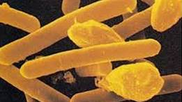 : : : : : : : : : : : : : : : : : : : : : 16.13. Clostridium-botulinum
