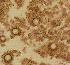 : : : : : : : : : : : : : : : : : : : : : 16.74. Aspergillus fumigatus
