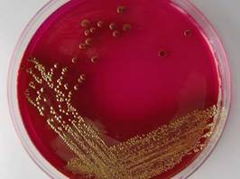 : : : : : : : : : : : : : 17.2.  E. coli    