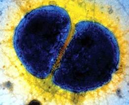: : : : : : : : : : : : : 17.7. Diplococcus septicus 