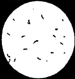 : : : : : : : : : : : : : 17.9. Diplococcus septicus (  ) 