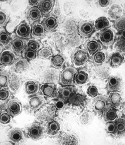 : : : : : : : : : : 18.11. ³  Herpesviridae