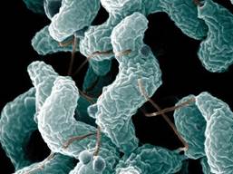 : : : : : : : : : : 18.21.Campylobacter fetus