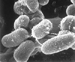 : : : : : : : : : : 18.25. Mycobacterium paratuberculosis 