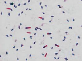 : : : : : : : : : : 18.28.C. septicum