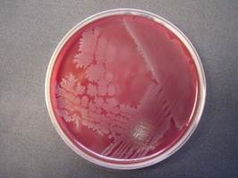 : : : : : : : : : : 18.29.  Cl.septicum   