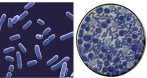 : : : : : : : : : : : 19.10. Erysipelothrix insidiosae 