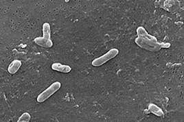 : : : : : : : : : : : 19.14. Bordetella bronchiseptica ( )