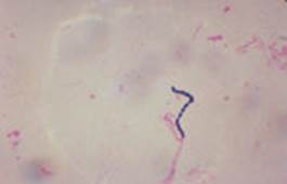 : : : : : : : : 20.5. Streptococcus egui 