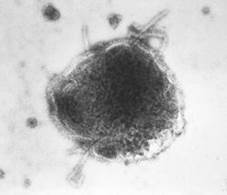 : : : : : : : : 21.17. ³  Paramyxoviridae