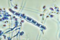 Pin Trichophyton Schoenleinii on Pinterest