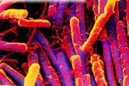 clostridium_bacteria