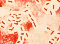 b323-5 Clostridium perfringens. India ink preparation showing capsules  Mayhew.jpg