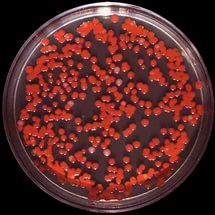 : : Serratia marcescens