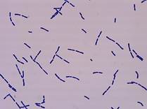 : :    Clostridium putrificum