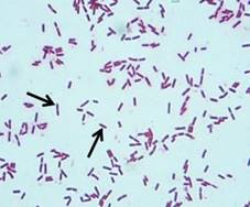 : : : : : : : : : : : : : : http://z-ferma.by/wp-content/uploads/2019/12/Grams-staining-of-Clostridium-chauvoei-showing-Gram-positive-short-thick-straight_Q320.jpg