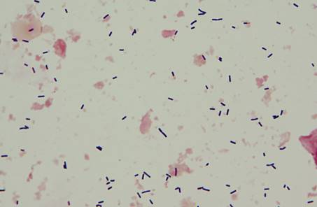 : : Clostridium perfringens - 