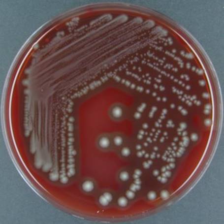 : : Fusobacterium necrophorum A