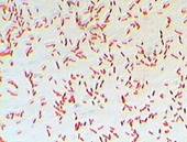 http://bogoduhovlib.ru/imagis/escherichia-coli-and-salmonella-71102-large.png