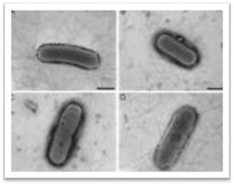 Fusiformis nodosis