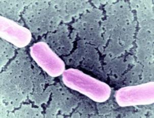 Botulism under a microscope. - Image Credit:BSIP/UIG/ Universal Images Group /Getty Images