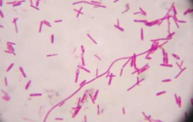 http://www.tipacilar.com/wp-content/uploads/2015/07/Clostridium-botulinum-spores.jpg