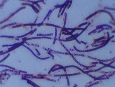 http://www.technology.org/texorgwp/wp-content/uploads/2014/03/Bacillus-Anthracis.jpg