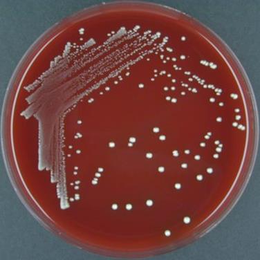 http://atlas.sund.ku.dk/microatlas/veterinary/bacteria/Fusobacterium_necrophorum_B/fusobacteriumnecrophorumb.jpg