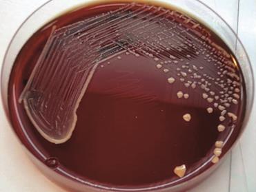 http://jpma.org.pk/images/May2013/Rhodococcus%20equi%20pneumonia%20figure3.jpg