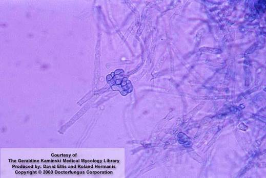 Trichphyton equinum microscopic morphology