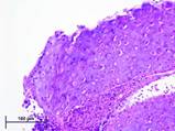 : : : : : : : : : : : Cytoplasmic inclusion bodies of avianpox virus infection